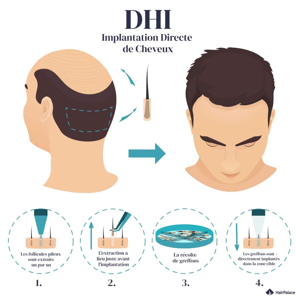 Clinique DHI Paris Nantes Lyon France
